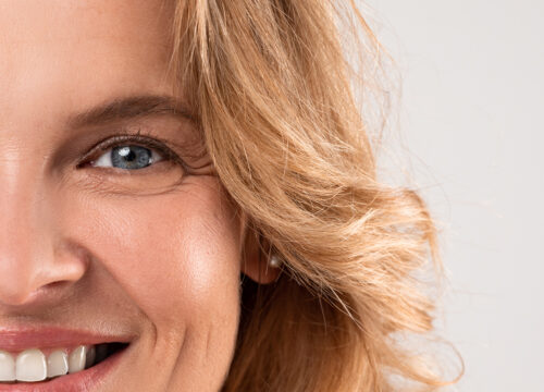 Photo of a smiling blonde woman with crow's feet around her eyes