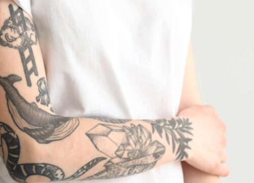 Photo of unwanted tattoos on a woman's arm